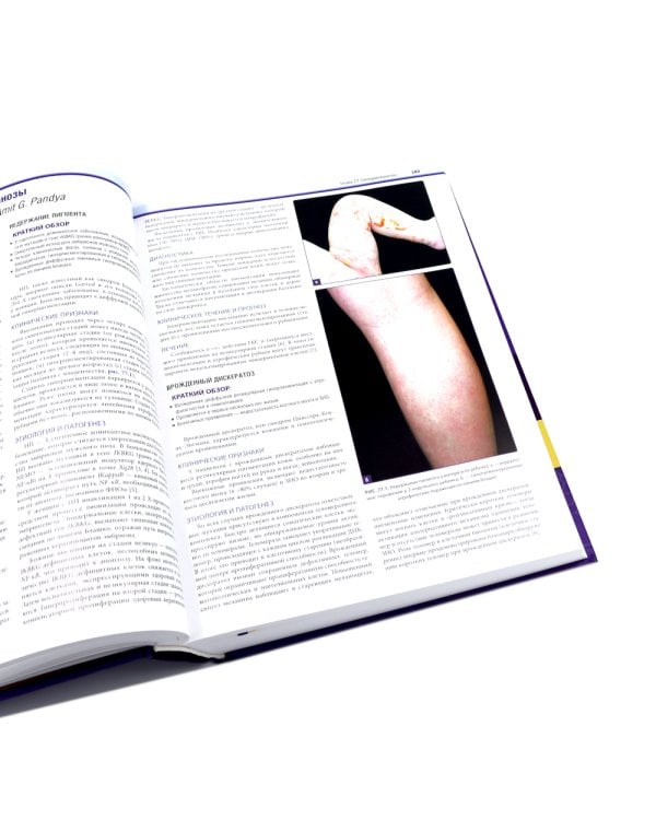 Дерматология по Фицпатрику. В 4 т (комплект)