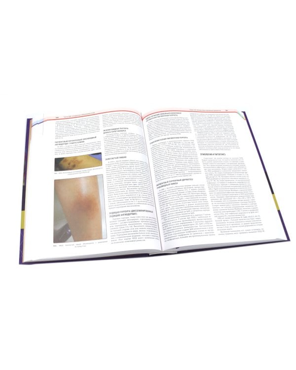 Дерматология по Фицпатрику. В 4 т (комплект)