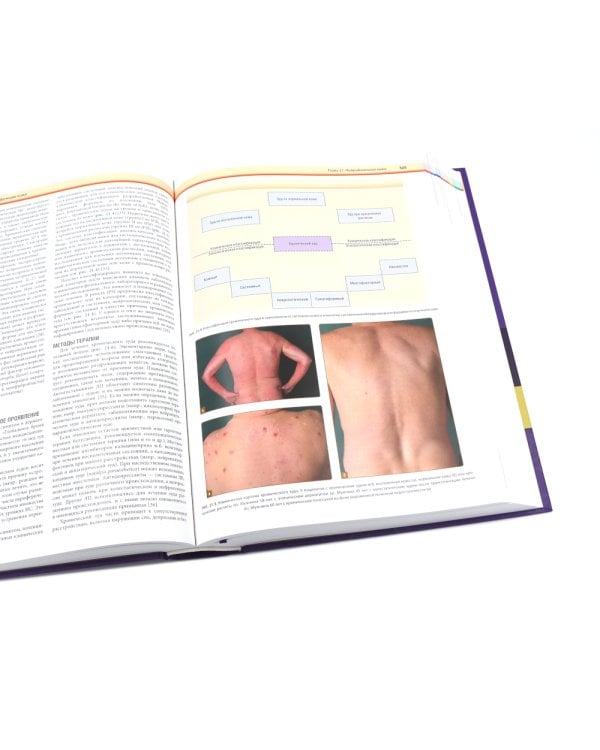 Дерматология по Фицпатрику. В 4 т (комплект)