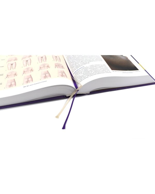 Дерматология по Фицпатрику. В 4 т (комплект)