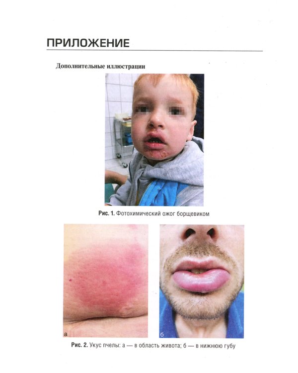 Неотложная и скорая медицинская помощь при острых отравлениях у детей: руководство для врачей и фельдшеров