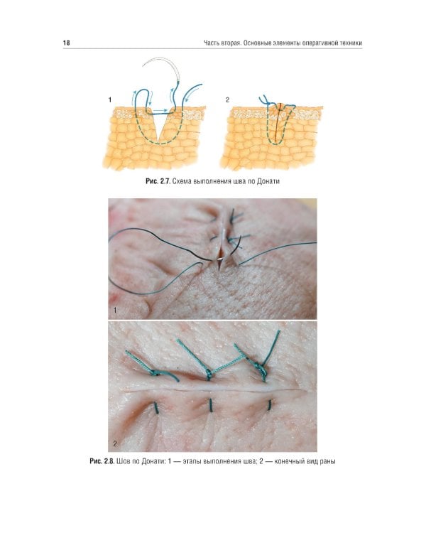 Топографическая анатомия и оперативная хирургия. Руководство к практическим занятиям. В 2 ч. Ч. 2: Основные элементы оперативной техники: Учебное посо