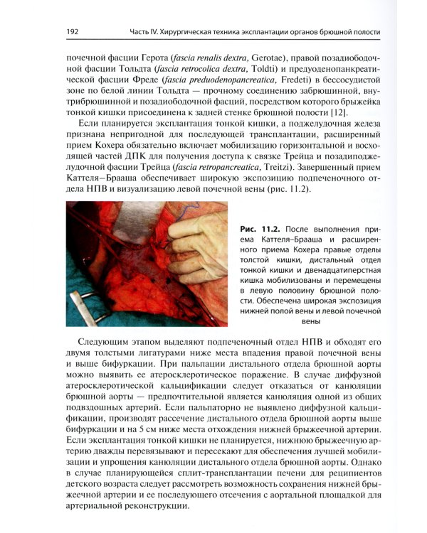 Мультиорганное донорство для трансплантации. Руководство по хирургической технике эксплантации органов