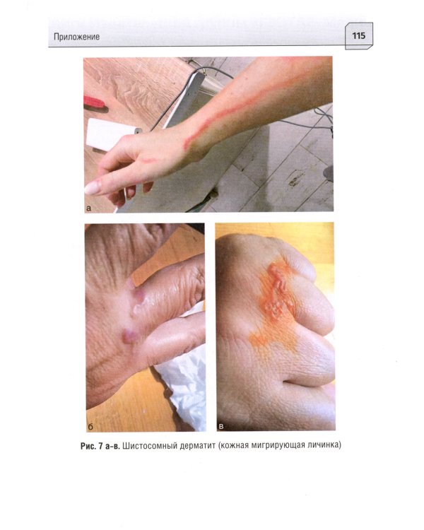 Неотложная и скорая медицинская помощь при острых отравлениях у детей: руководство для врачей и фельдшеров