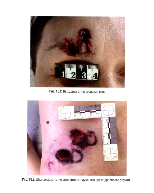 Судебная медицина. Учебник для юристов. 2-е изд., перераб