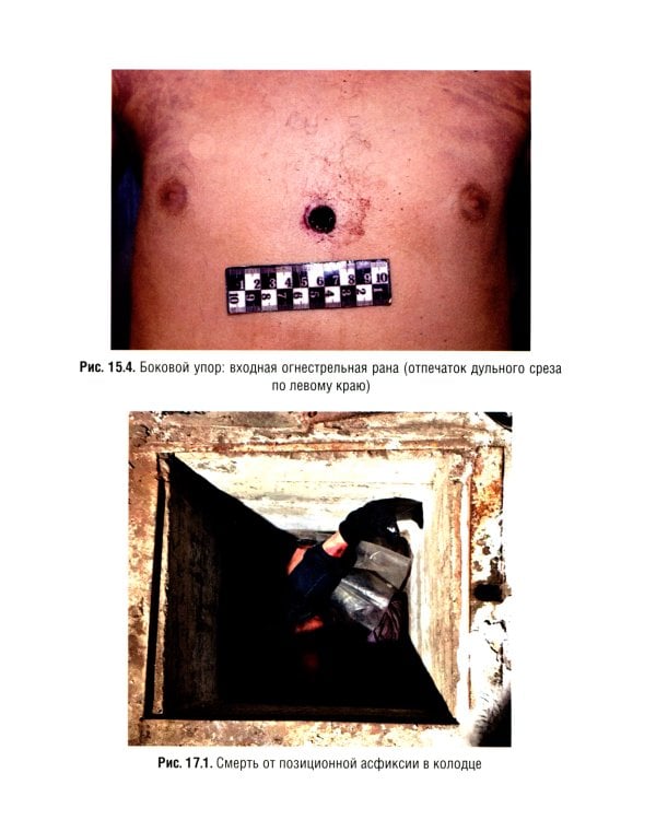 Судебная медицина. Учебник для юристов. 2-е изд., перераб