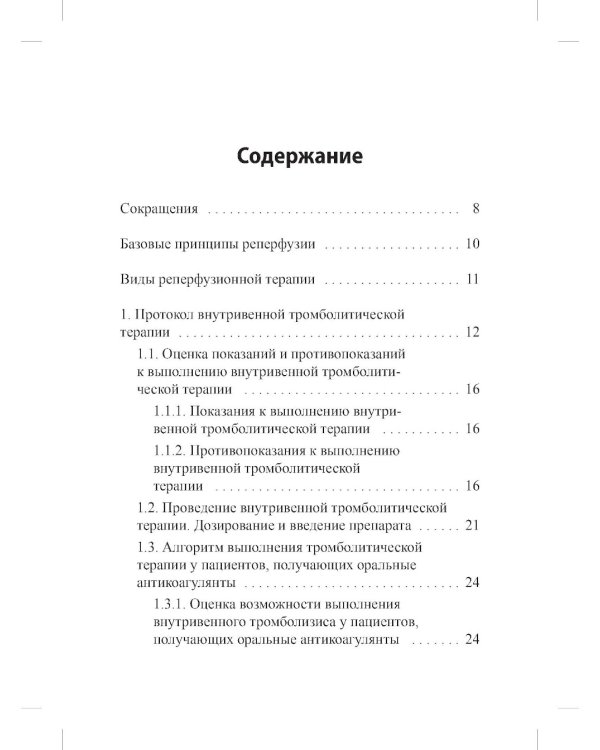 Реперфузионная терапия ишемического инсульта. Клинический протокол