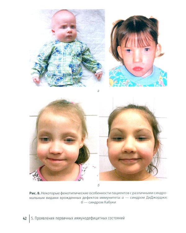 Врожденные дефекты иммунитета: диагностика и терапия: руководство для врачей