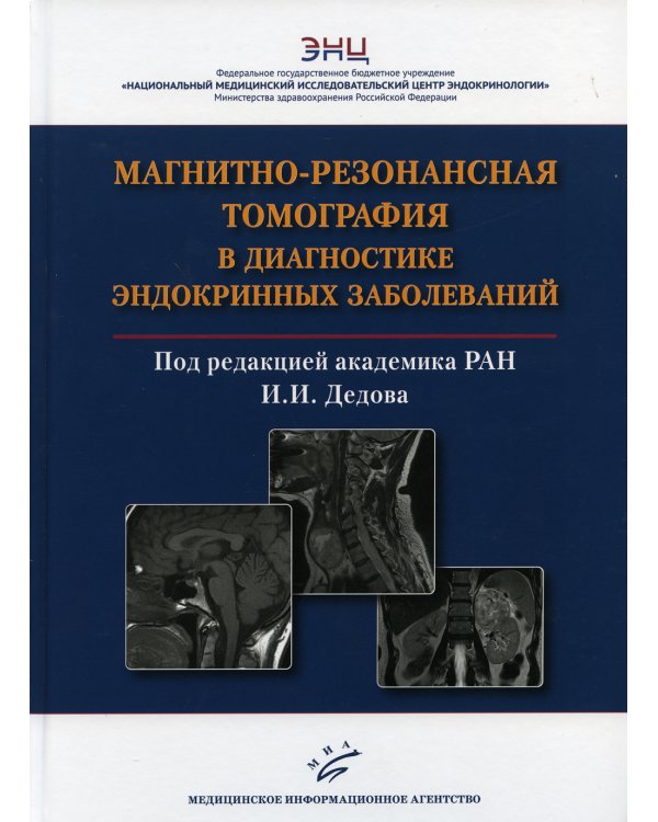 Магнитно-резонансная томография в диагностике эндокринных заболеваний