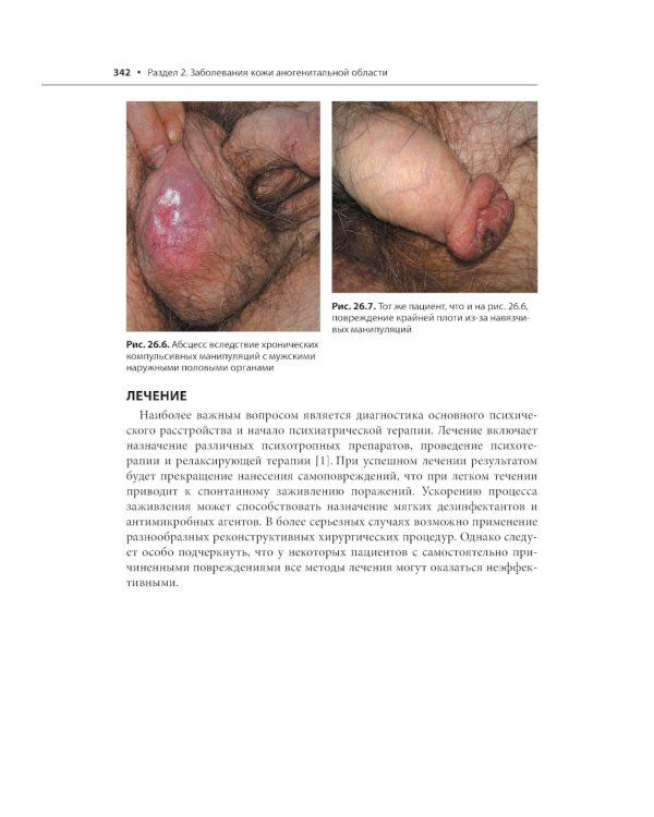 Генитальные и перианальные заболевания / Томас Ф. Мрочковски, Ларри Э. Милликан, Лоуренс Чарльз Париш ; пер. с англ. под ред. В. А. Молочкова. — М. : 