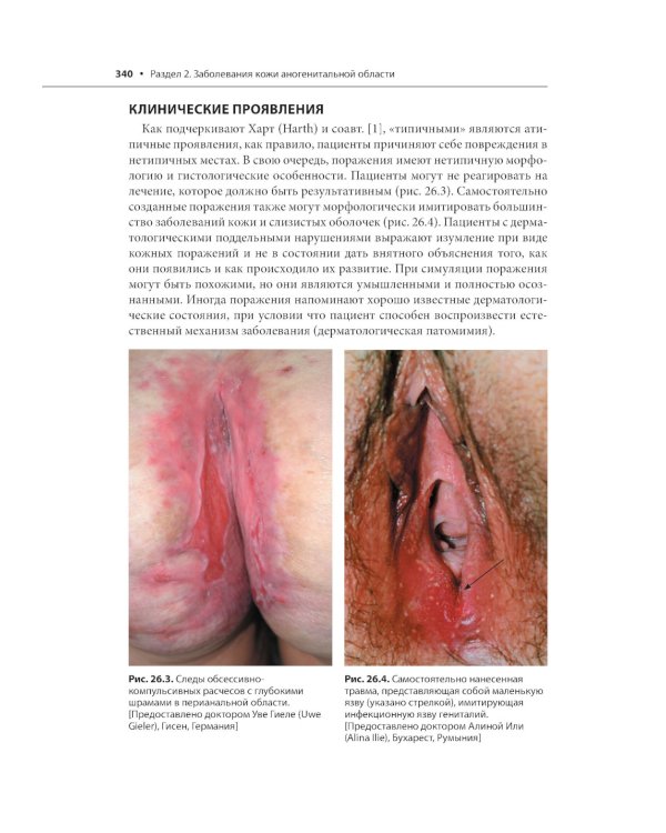 Генитальные и перианальные заболевания / Томас Ф. Мрочковски, Ларри Э. Милликан, Лоуренс Чарльз Париш ; пер. с англ. под ред. В. А. Молочкова. — М. : 