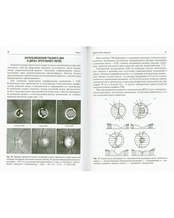 Патогенез и лечение первичной открытоугольной глаукомы: руководство для врачей