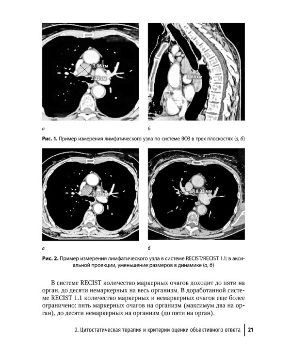 Современная лекарственная терапия злокачественных опухолей и оценка ее эффективности: руководство для врачей