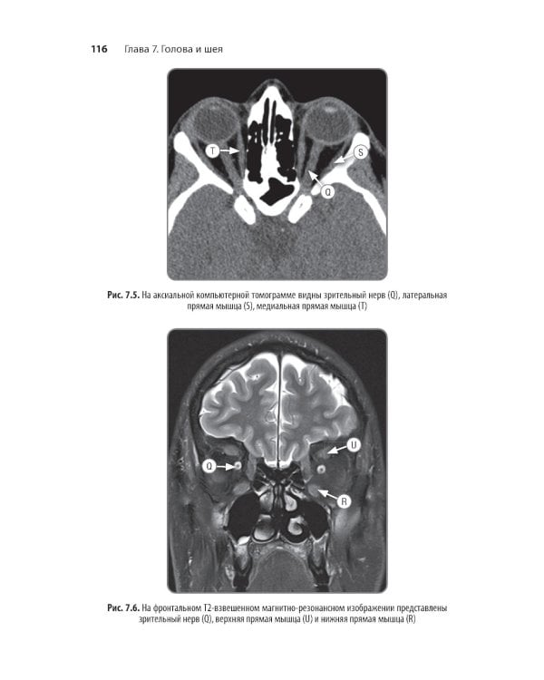 Неотложная радиология: карманный справочник