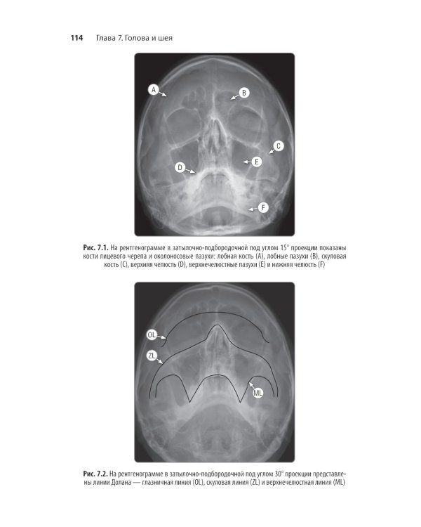 Неотложная радиология: карманный справочник