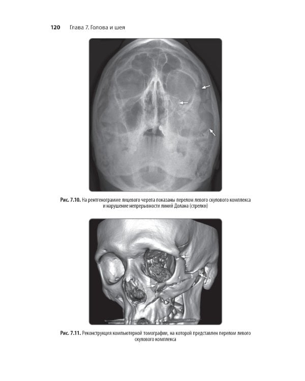 Неотложная радиология: карманный справочник