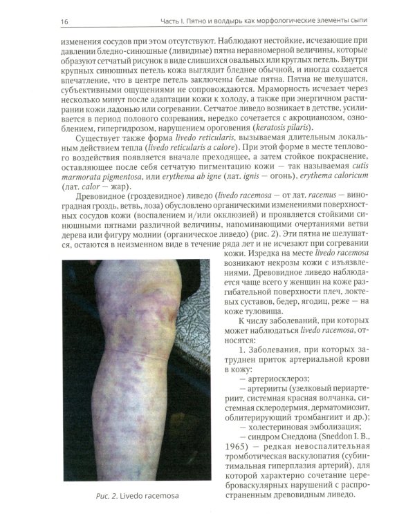 Клиническая дерматовенерология. Т. 2. Пятнистые и уртикарные дерматозы