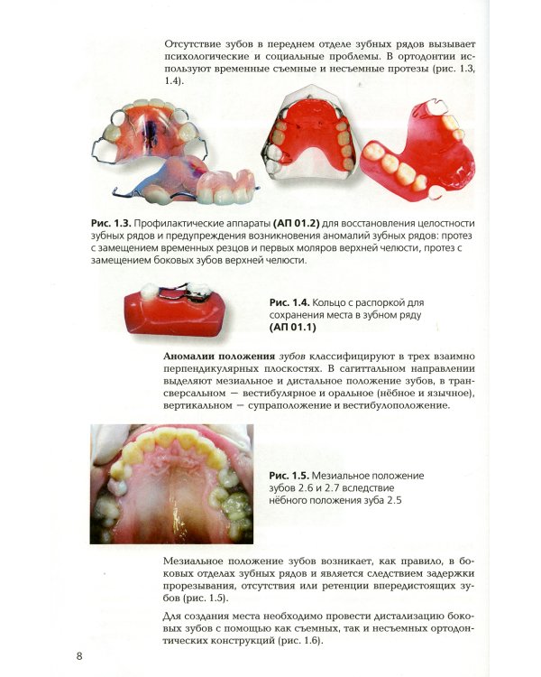 Ортодонтия. Ортодонтические аппараты при лечении зубочелюстных аномалий