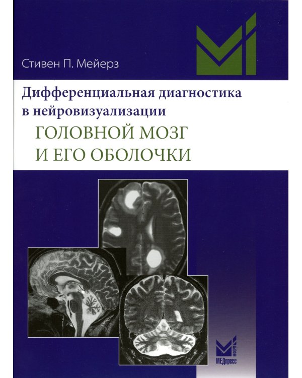 Дифференциальная диагностика в нейровизуализации. Головной мозг и его оболочки