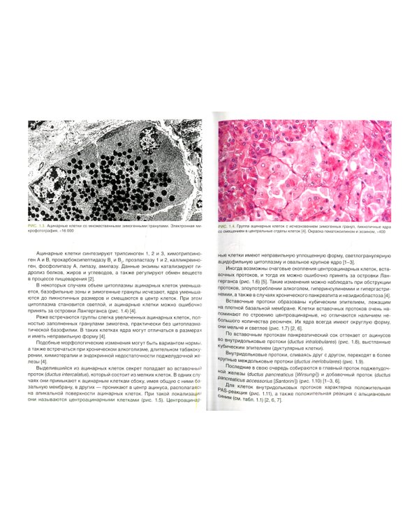 Патоморфологическая диагностика опухолеподобных образований поджелудочной железы. Руководство для врачей