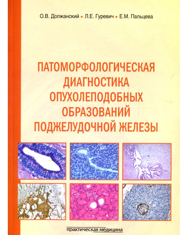 Патоморфологическая диагностика опухолеподобных образований поджелудочной железы. Руководство для врачей