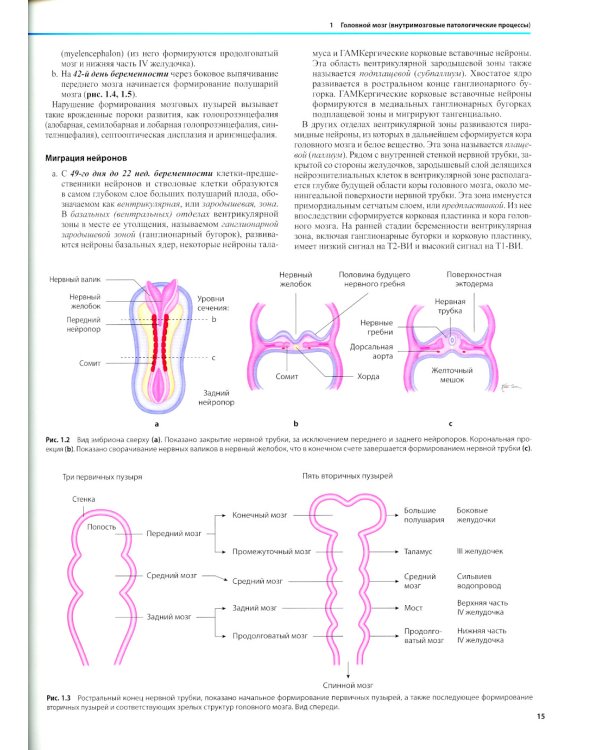 Дифференциальная диагностика в нейровизуализации. Головной мозг и его оболочки