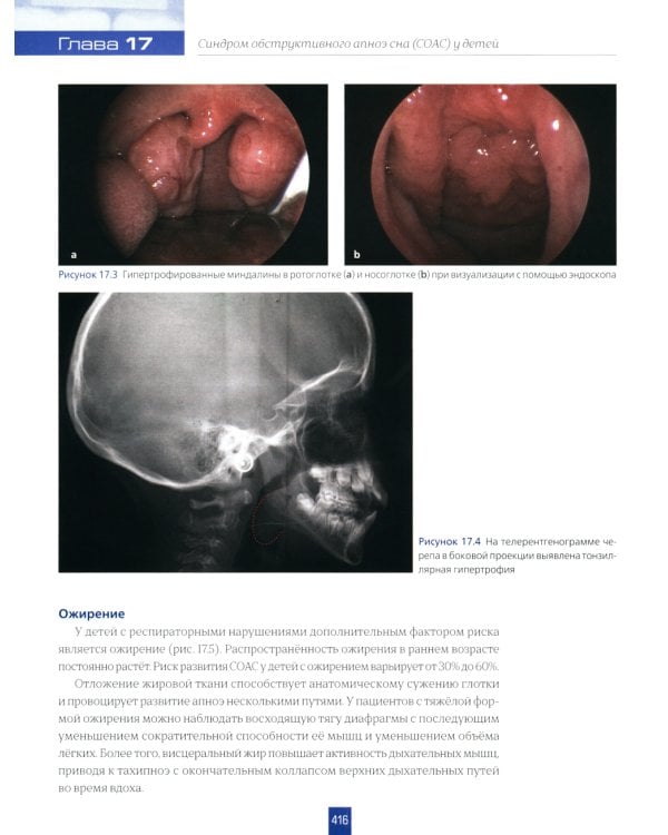 Детская стоматология. 2-е изд