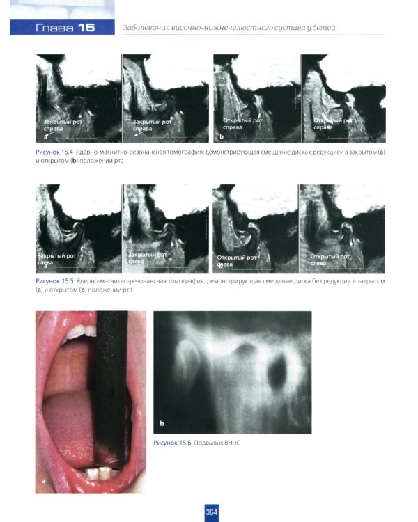 Детская стоматология. 2-е изд