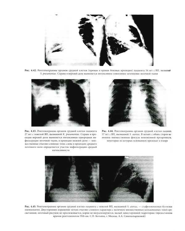 Основы внутренней медицины. В 2 т., в 2 кн. (комплект из 2-х кн.): Руководство для врачей. 2-е изд., перераб.и доп