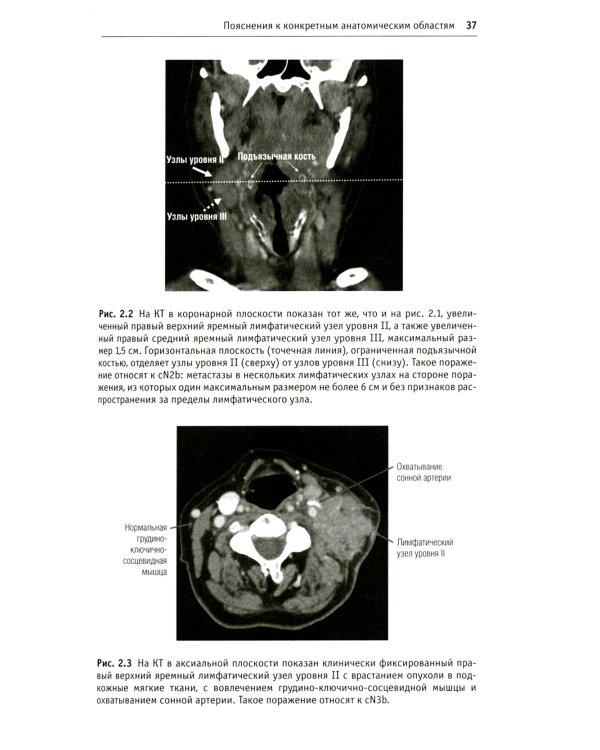 Дополнения к классификации TNM: комментарии для единообразного применения