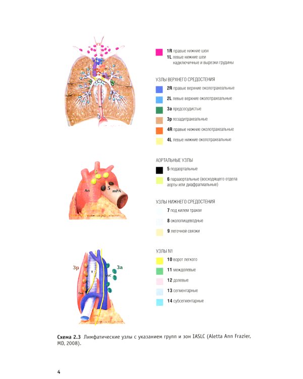 Дополнения к классификации TNM: комментарии для единообразного применения
