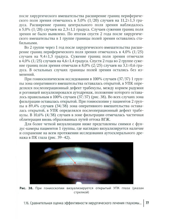 Дренажная хирургия глаукомы: руководство для врачей