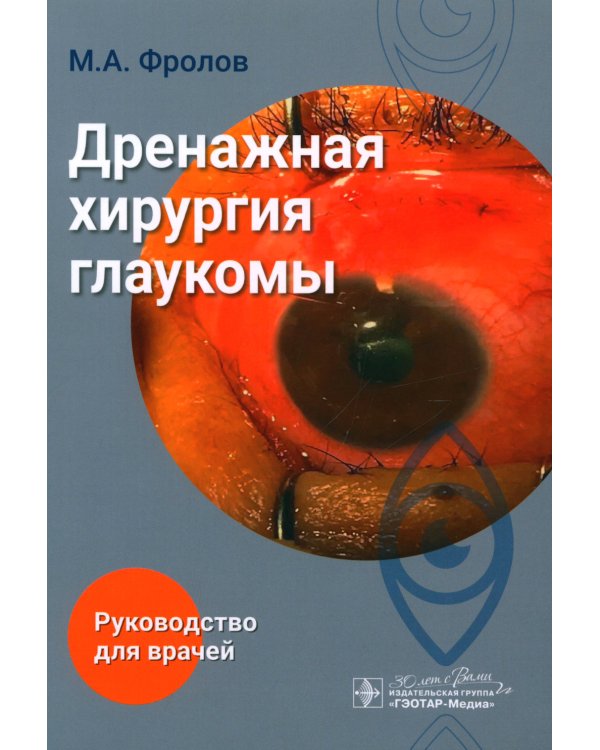 Дренажная хирургия глаукомы: руководство для врачей
