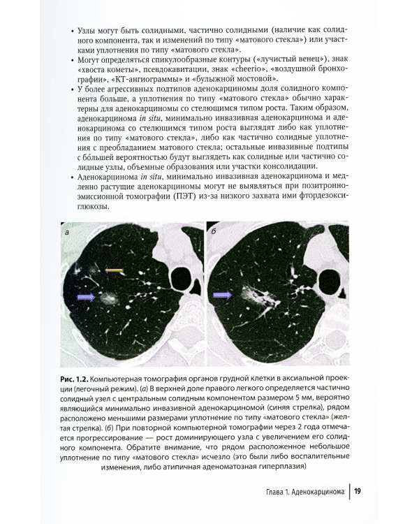 Диагностическая визуализация при заболеваниях легких. Практическое руководство
