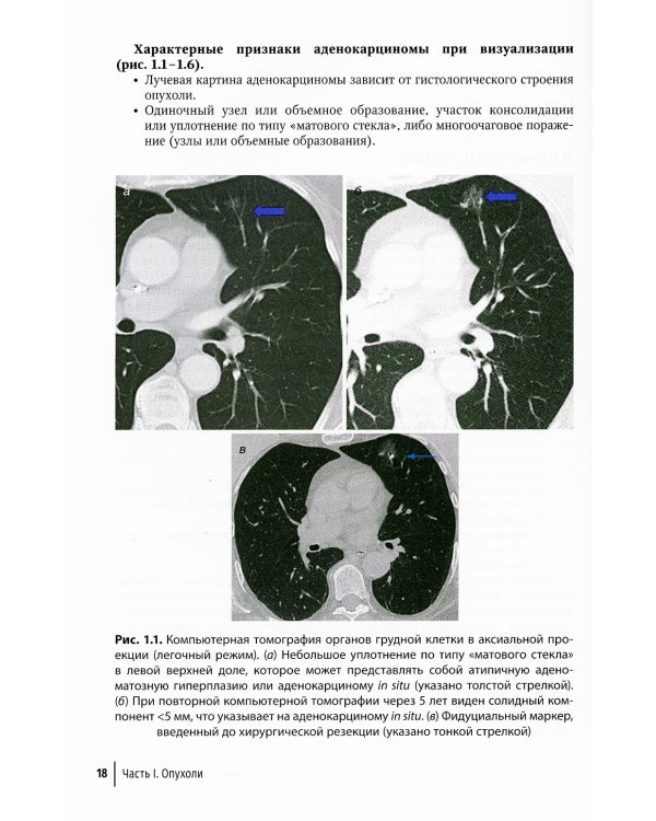 Диагностическая визуализация при заболеваниях легких. Практическое руководство