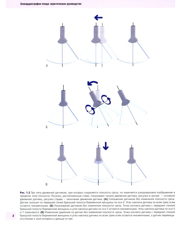 Эхокардиография плода: практическое руководство. + DVD