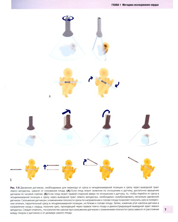 Эхокардиография плода: практическое руководство. + DVD