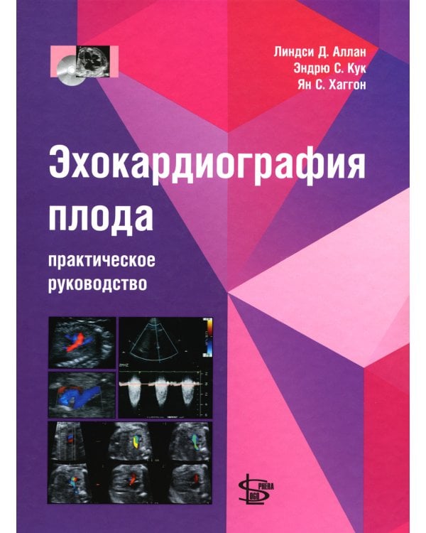 Эхокардиография плода: практическое руководство. + DVD