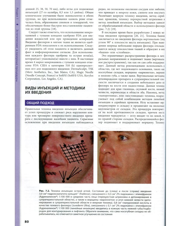 Процедуры в дерматологии. Клиническая косметология