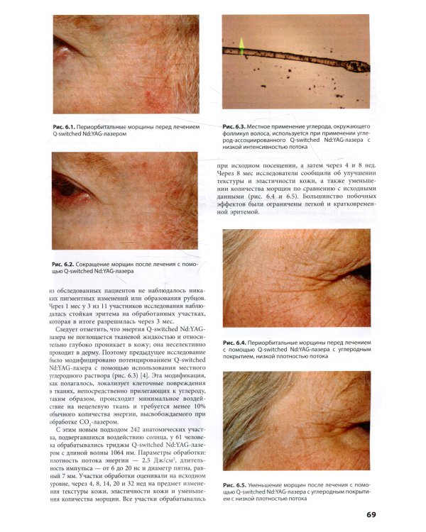 Процедуры в дерматологии. Клиническая косметология