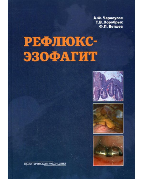 Рефлюкс-эзофагит