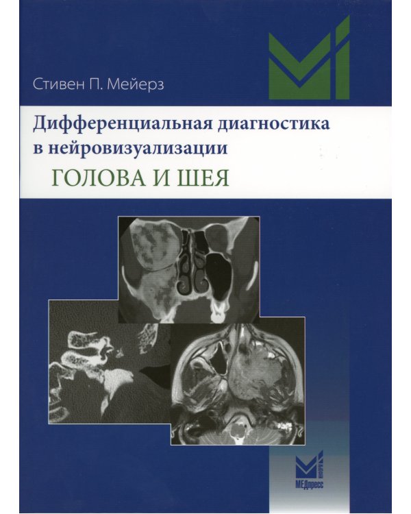 Дифференциальная диагностика в нейровизуализации. Голова и шея