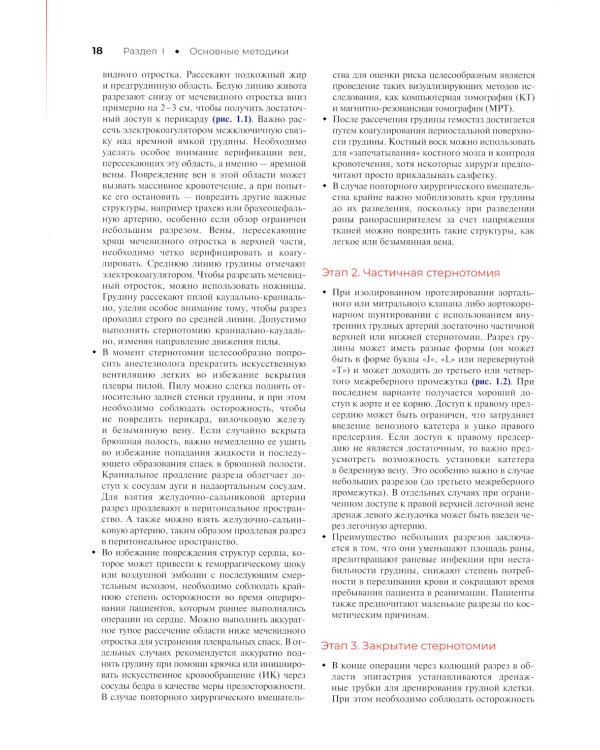 Атлас кардиохирургических операций