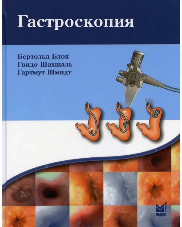 Гастроскопия