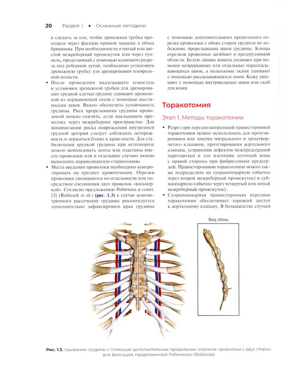 Атлас кардиохирургических операций