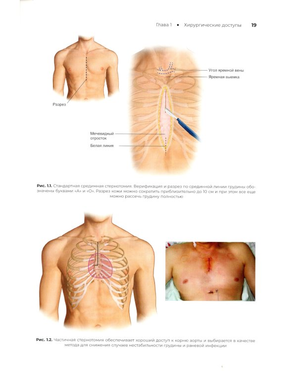 Атлас кардиохирургических операций