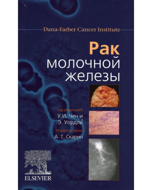 Рак молочной железы