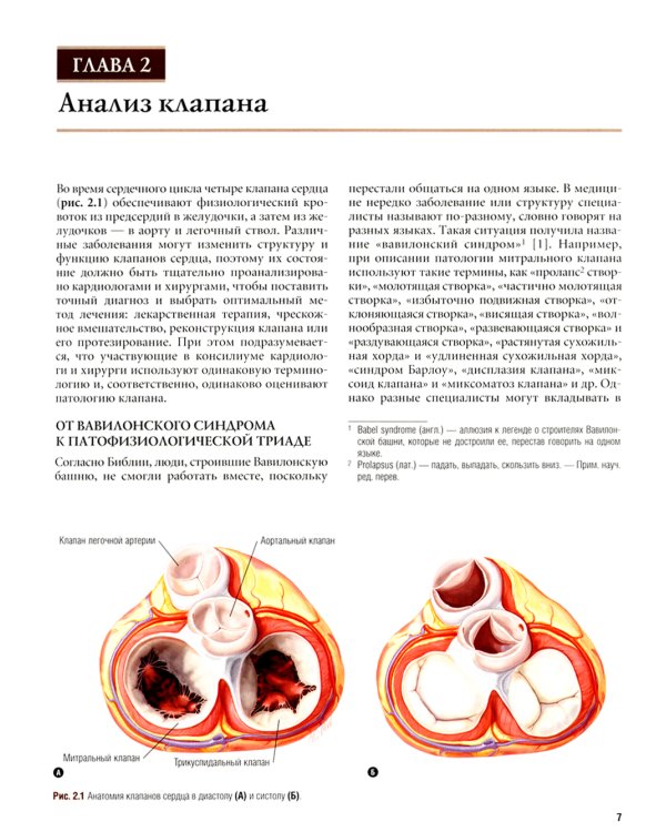Реконструктивная хирургия клапанов сердца по Карпантье: от анализа клапана к его реконструкции