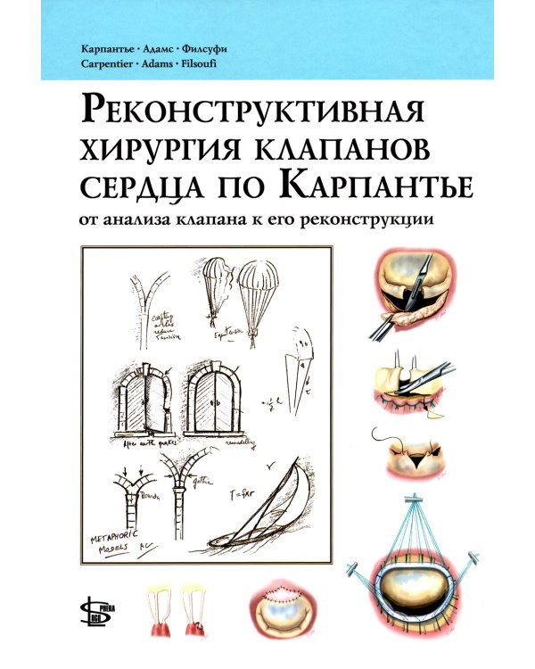 Реконструктивная хирургия клапанов сердца по Карпантье: от анализа клапана к его реконструкции