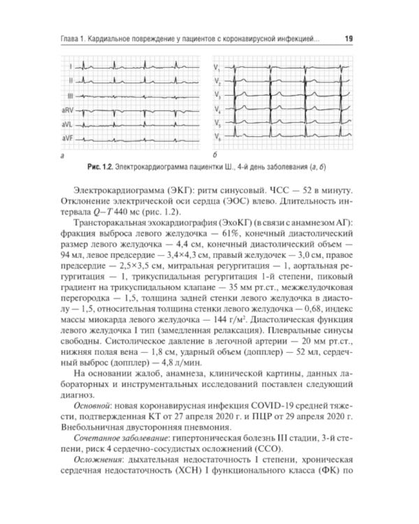 Трудный пациент с COVID-19. Междисциплинарный подход: Учебное пособие